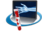 Hand x-ray and blood vial of a patient